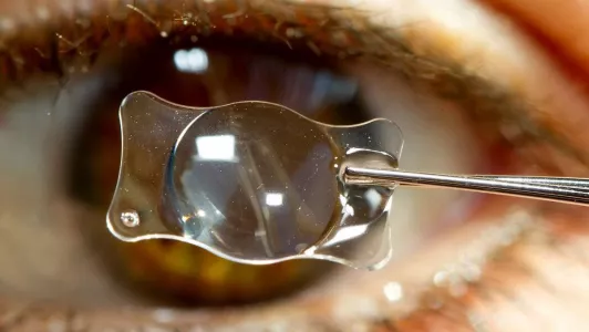 Послеоперационная реабилитация после удаления катаракты